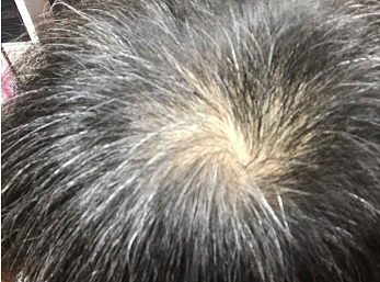 当店は薄毛 脱毛等髪のお悩み相談と健やかな育毛環境に導くお手伝いをして居ります 理容 和やか
