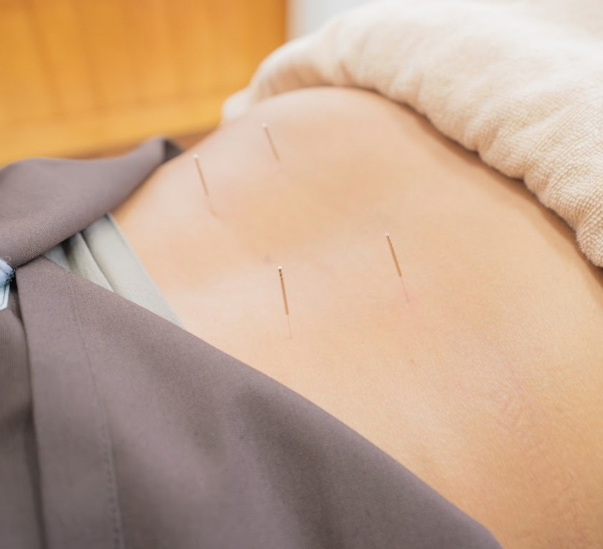 腰痛でお悩みの方へ