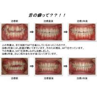 見えない矯正治療とは？