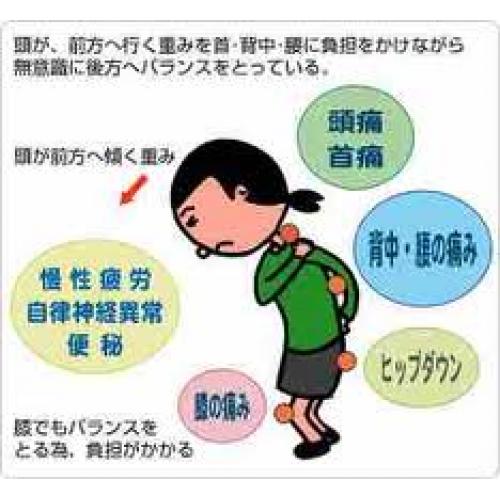 関節のずれや歪みについて <身体の不調の根本原因>