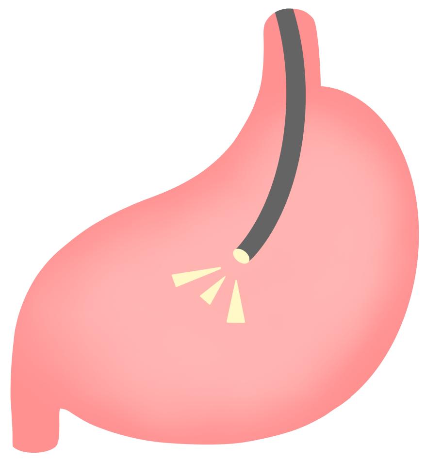 ペットの内視鏡検査とは？切らずに異物を取り出す方法