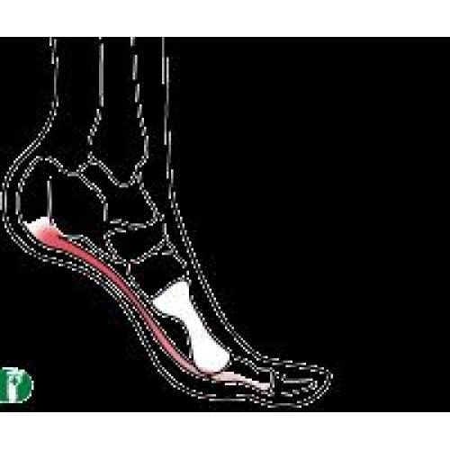 足裏が痛い　(足底筋膜炎・足底腱膜炎)