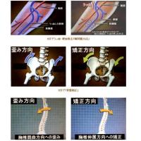 運動器系疾患の方