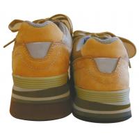 ハイアーチの症状、原因、靴と中敷きによる対策